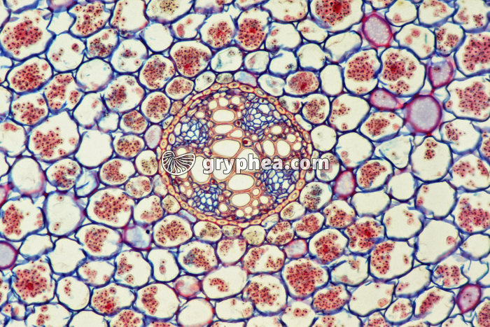 Cellules de racine de Ficaire CT x10 - gryphea.org